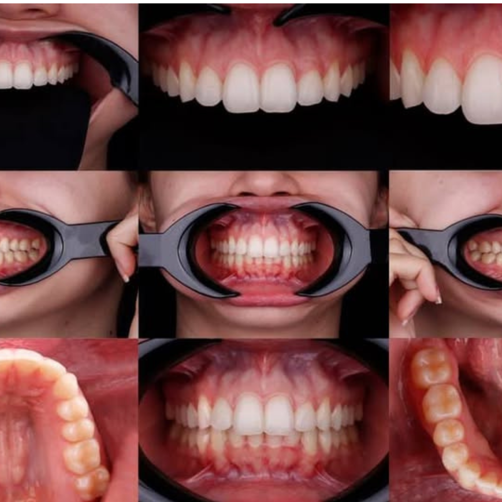 Fotografía Clínica