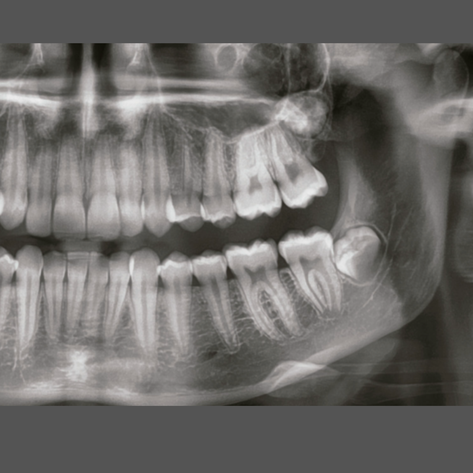 Radiografía Panorámica