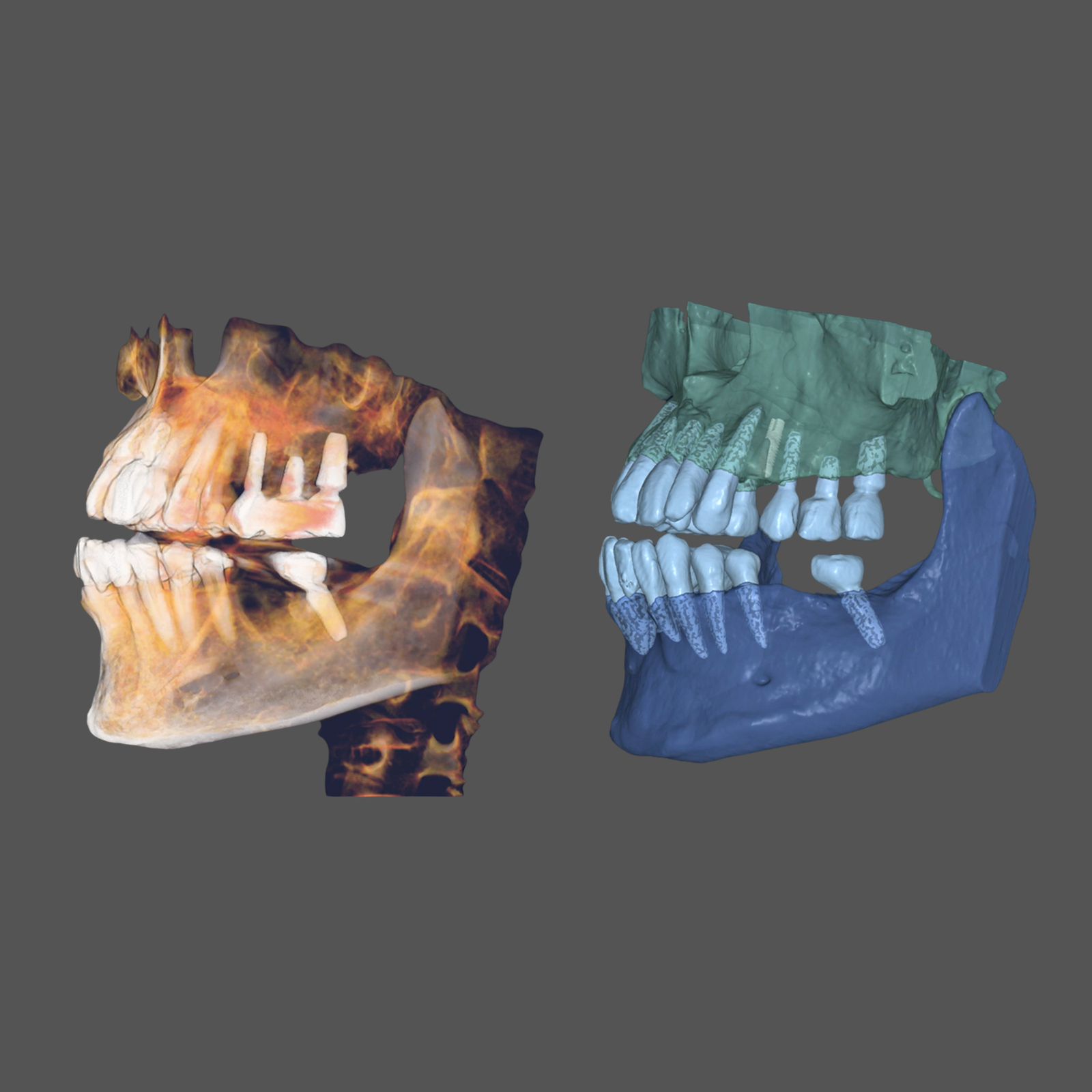 Tomografía Cone Beam